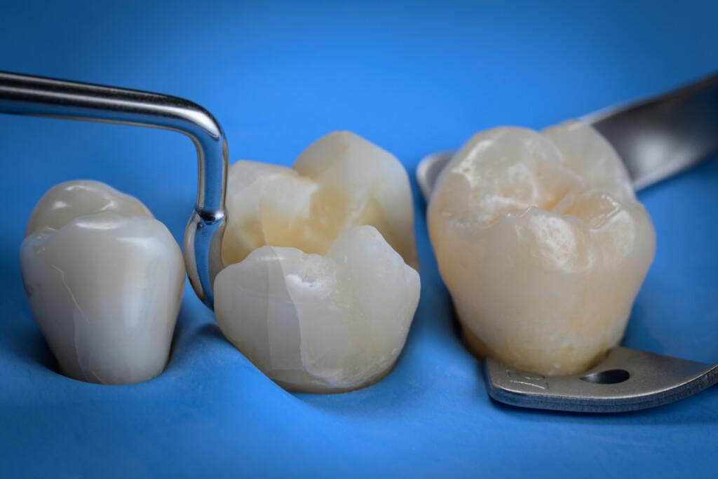 Contact-Shaper-Mesial2-1-1024x683.jpg